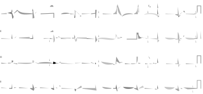 12leadb clipart