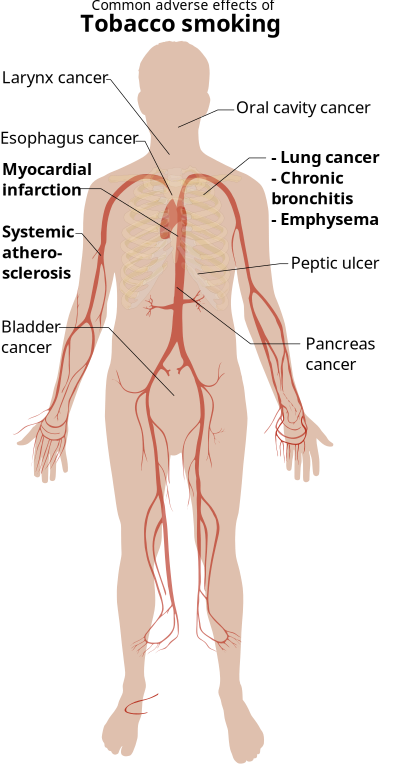 Adverse Effects Of Tobacco Smoking clipart