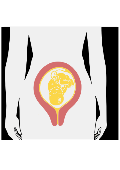 Antepartum woman clipart