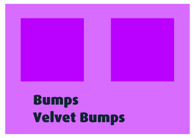 Bumps Velvet Bumps clipart