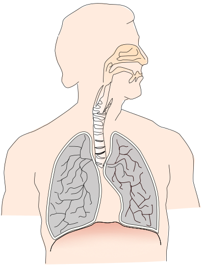 Cancer caused by smoking I clipart