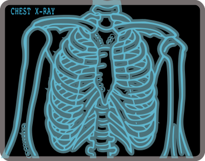 Chest X-ray clipart