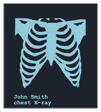 Chest X-ray image clipart