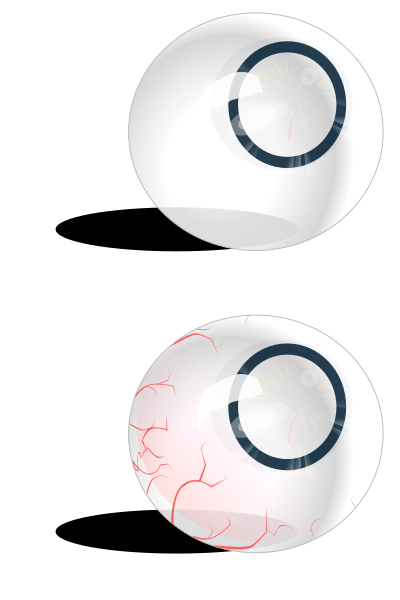 Eyeball blue & bloodshot clipart