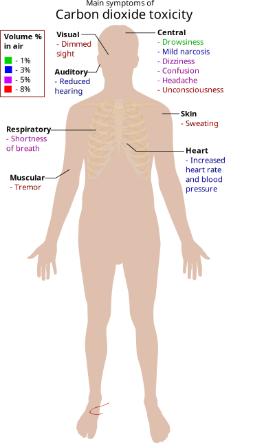 Main Symptoms Of Carbon Dioxide Toxicity clipart
