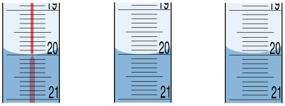 Meniskus - verschiedene Varianten clipart