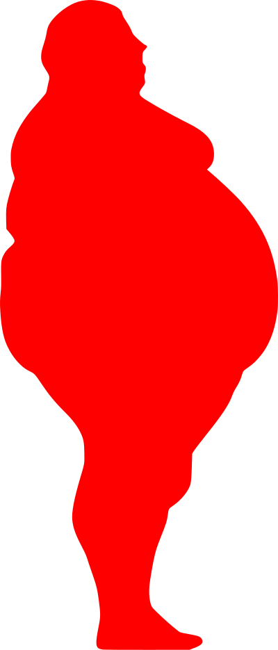 Morbid Obesity (Class III) clipart