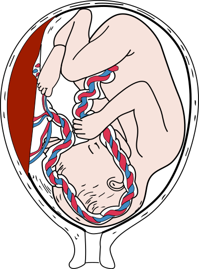 Placenta and Fetus clipart